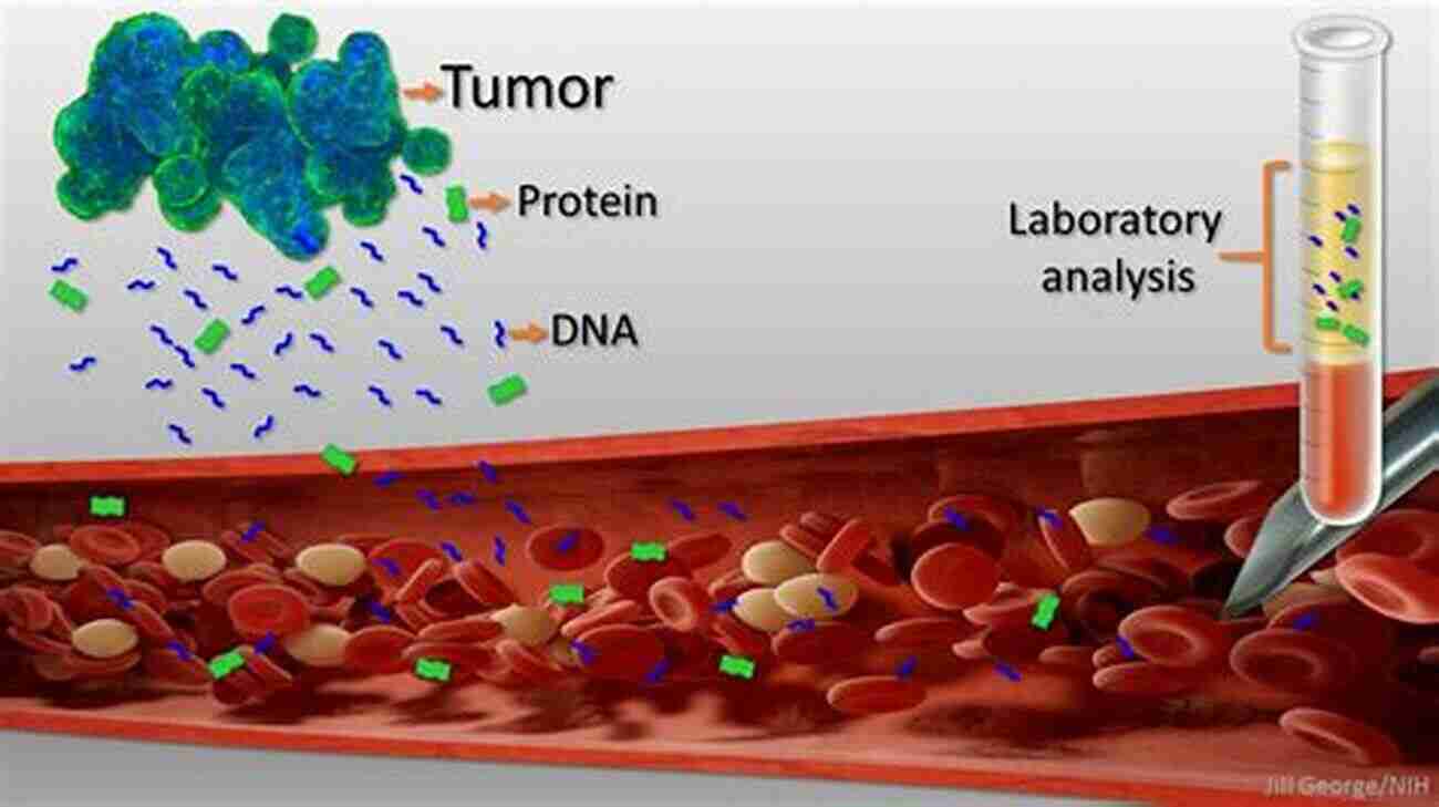 Liquid Biopsies For Cancer Detection Advances In Clinical Chemistry (Volume 33)