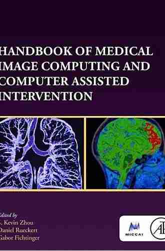 Handbook Of Medical Image Computing And Computer Assisted Intervention (The MICCAI Society Series)